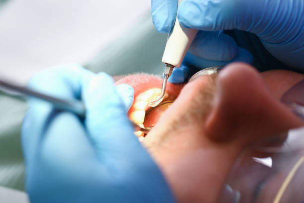 Best Emergency Gum Treatment in Atwood, IL