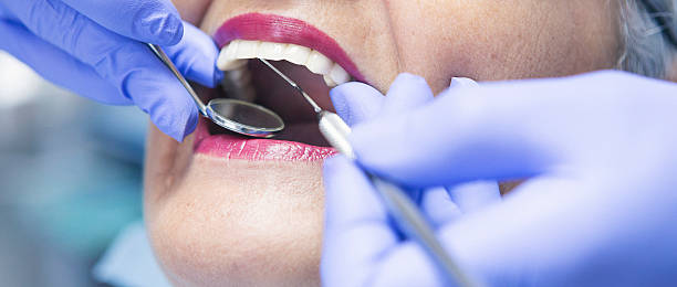 Best Emergency Tooth Extraction in Atwood, IL